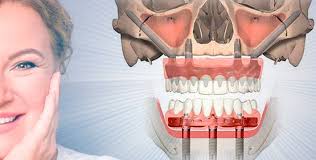 Стоматологическая клиника Май Смайл - Ваш идеальный выбор для здоровья зубов Стоматологическая клиника Май Смайл - Ваш идеальный выбор для здоровья зубов